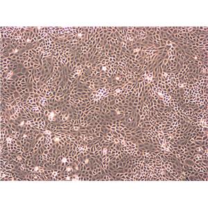 HO-8910 Cells|人卵巢癌需消化细胞系