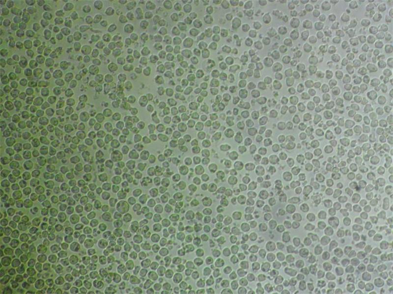 U-937 Cells|人组织细胞淋巴瘤可传代细胞系,U-937 Cells
