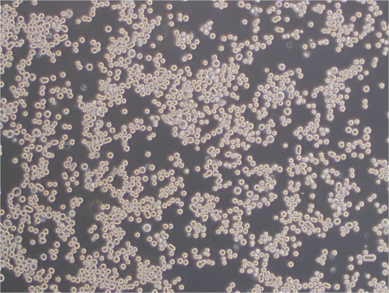 HL-60 Clone 15 Cells|人急性早幼粒細(xì)胞白血病可傳代細(xì)胞系,HL-60 Clone 15 Cells