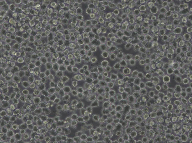SK-MEL-2 Cells|恶性黑色素瘤需消化细胞系,SK-MEL-2 Cells