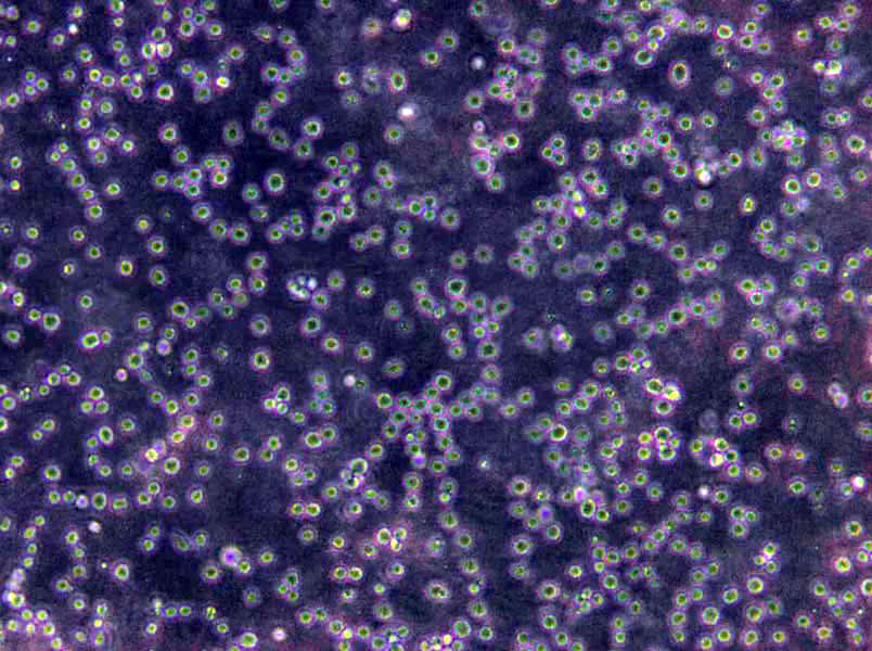 NCM356 Cells|结直肠腺癌需消化细胞系,NCM356 Cells
