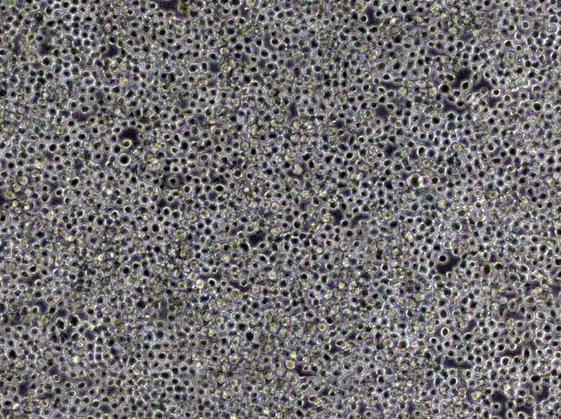 COR-L105 Cells|原发性非小Cell肺癌需消化细胞系,COR-L105 Cells