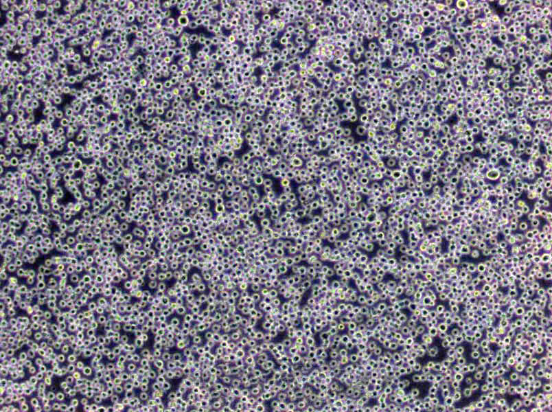 COR-L279 Cells|肺小Cell癌需消化細(xì)胞系,COR-L279 Cells