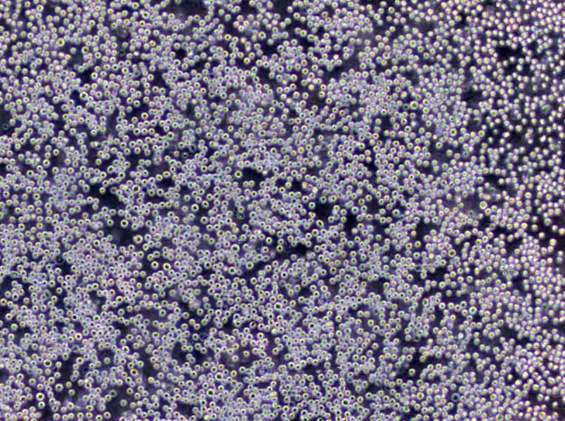 PIG1 Cells|正常皮肤黑色素需消化细胞系,PIG1 Cells
