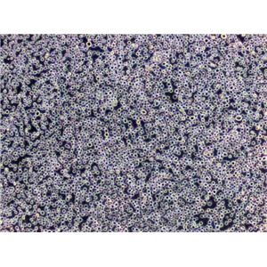 COR-L279 Cells|肺小Cell癌需消化细胞系