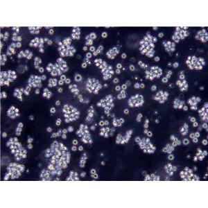 COLO 201 Cells|结直肠腺癌需消化细胞系
