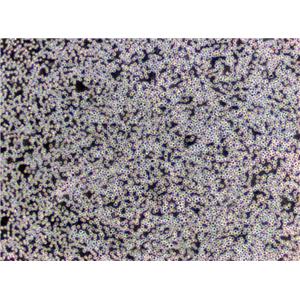 SNU-251 Cells|卵巢内膜癌需消化细胞系,SNU-251 Cells