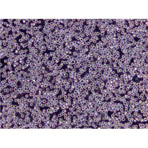 SNU-869 Cells|胆管癌需消化细胞系