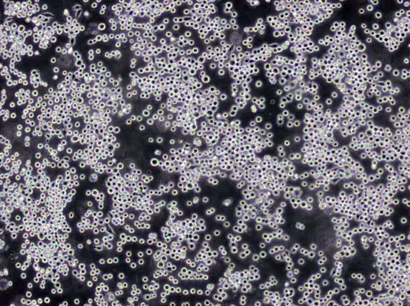 CC-LP-1 Cells|胆管癌需消化细胞系,CC-LP-1 Cells