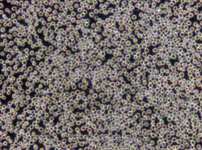 A-549 Cells|肺癌需消化细胞系,A-549 Cells