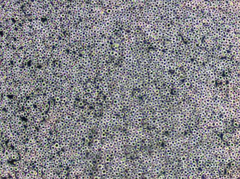 NCL-H548 Cells|胰腺癌需消化细胞系,NCL-H548 Cells