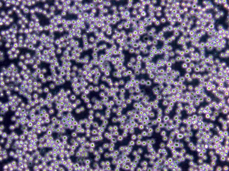 COR-L26 Cells|肺癌需消化細(xì)胞系,COR-L26 Cells