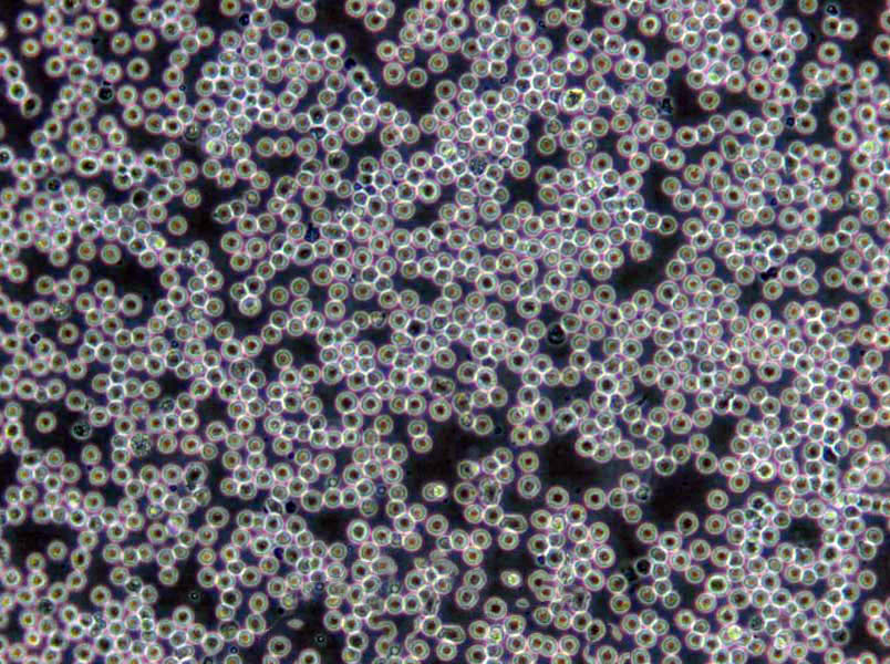 SNU-407 Cells|结肠癌需消化细胞系,SNU-407 Cells