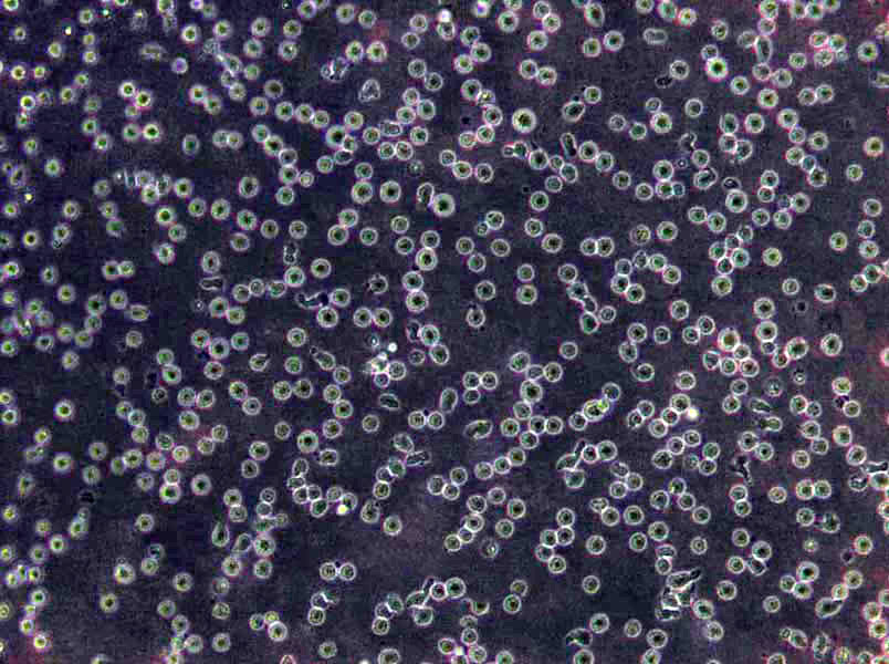 NCI-H1876 Cells(赠送Str鉴定报告)|人小细胞肺癌细胞,NCI-H1876 Cells