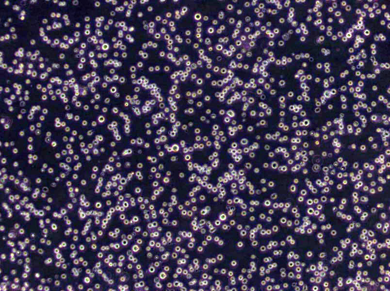 NCI-H2444 Cells(赠送Str鉴定报告)|人非小细胞肺癌细胞,NCI-H2444 Cells