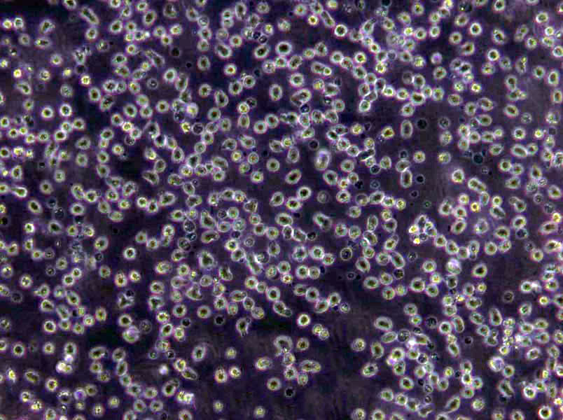 NCI-H647 Cells(赠送Str鉴定报告)|人非小细胞肺癌细胞,NCI-H647 Cells