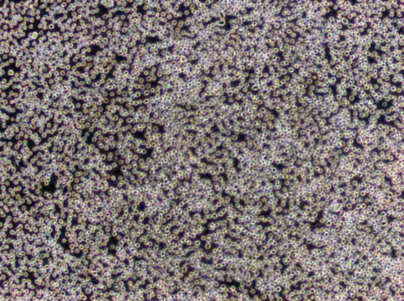 NCI-H1373 Cells(赠送Str鉴定报告)|人肺癌腺癌细胞,NCI-H1373 Cells