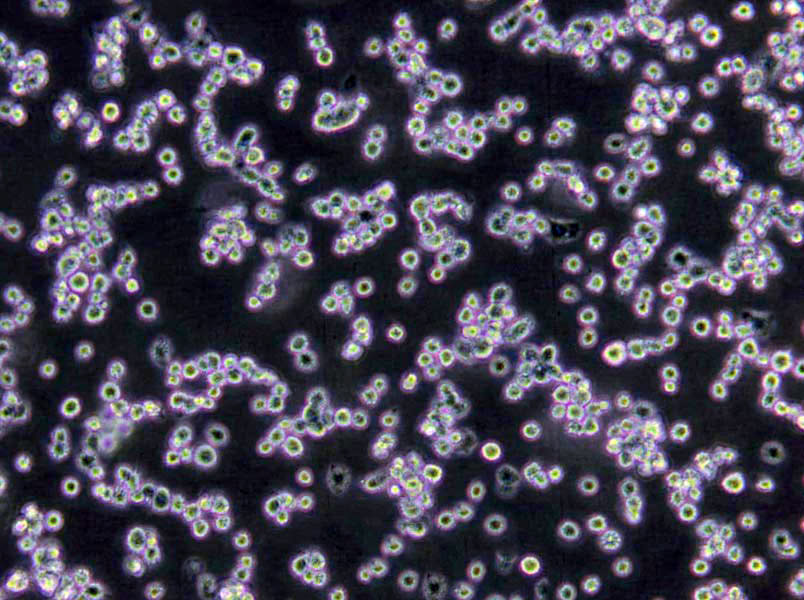 NCI-H747 Cells(赠送Str鉴定报告)|人盲肠癌细胞,NCI-H747 Cells