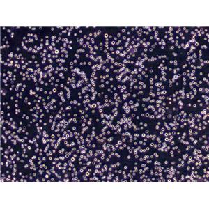 NCI-H1568 Cells(赠送Str鉴定报告)|人非小细胞肺癌细胞