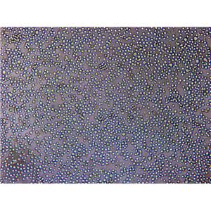 NCI-H1693 Cells(赠送Str鉴定报告)|人非小细胞肺癌细胞