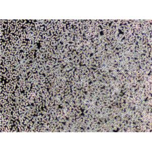 NCI-H322 Cells(赠送Str鉴定报告)|人肺癌细胞