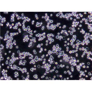 NCI-H747 Cells(赠送Str鉴定报告)|人盲肠癌细胞