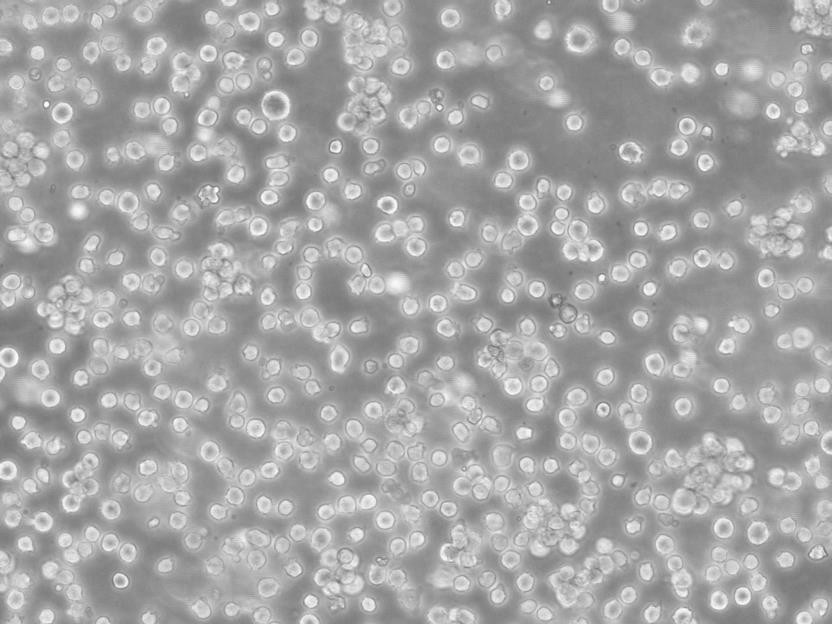 MT-4 Cell急性淋巴母细胞白血病传代培养,MT-4 Cell