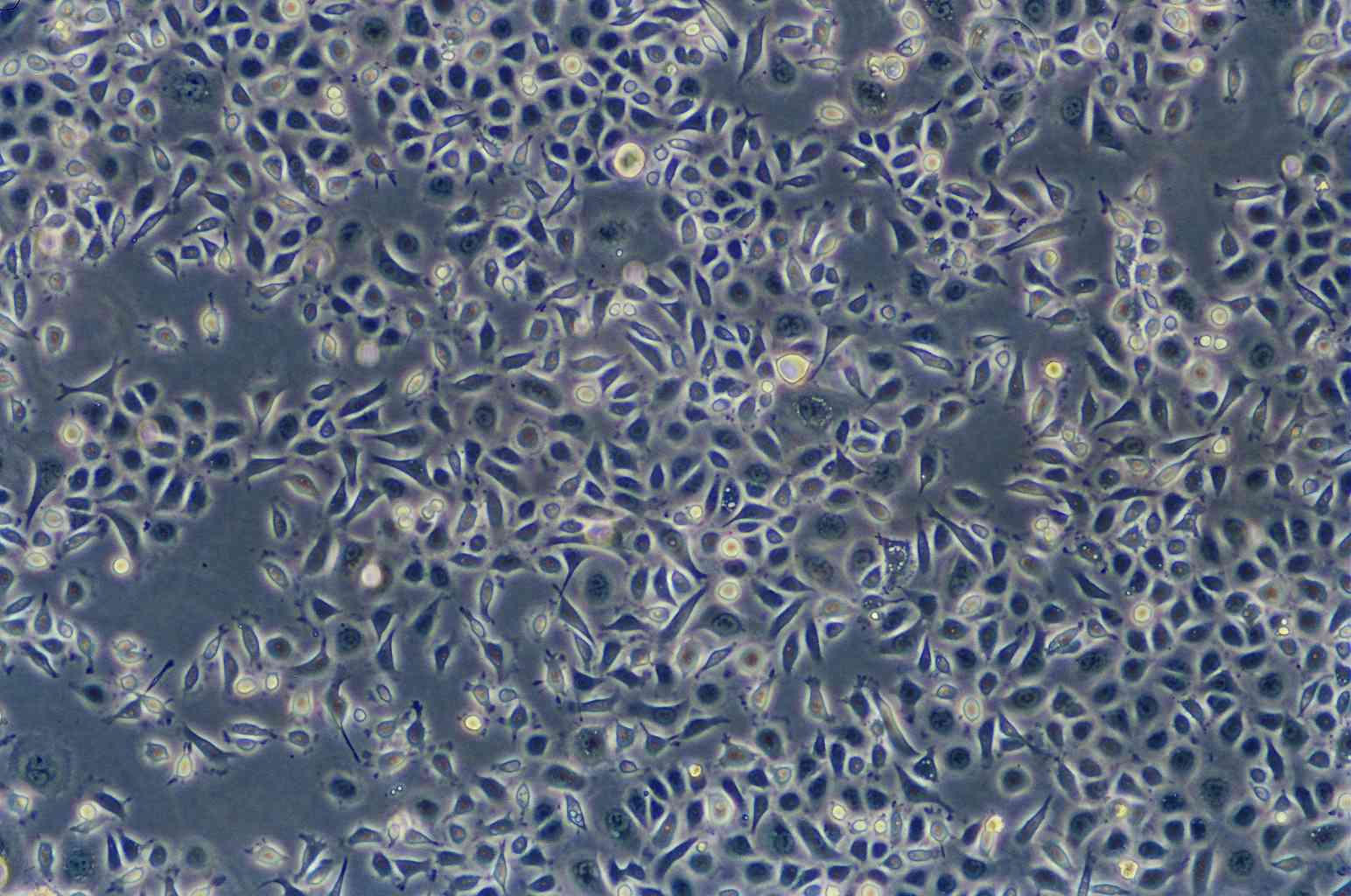 NCI-H676B人肺腺癌复苏细胞(附STR鉴定报告),NCI-H676B