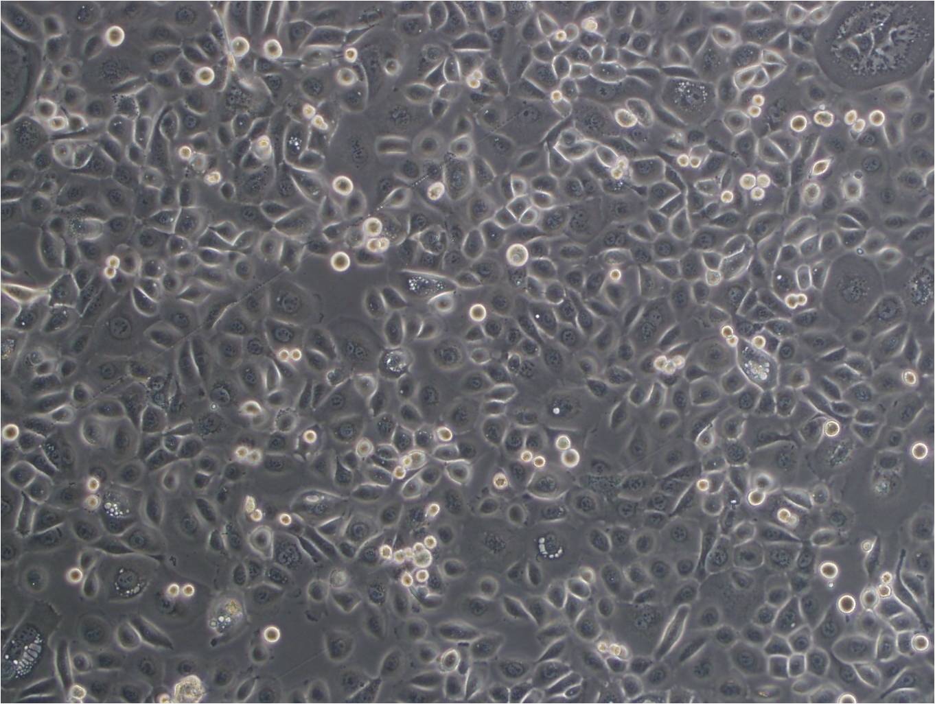 Ca761小鼠乳腺癌复苏细胞(附STR鉴定报告),Ca761