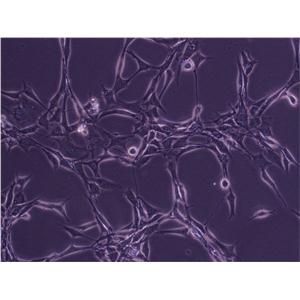 NS20Y小鼠神经母细胞瘤复苏细胞(附STR鉴定报告)