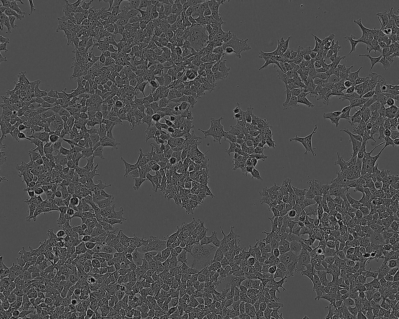 C32 [Human melanoma]人黑色素瘤复苏细胞(附STR鉴定报告),C32 [Human melanoma]