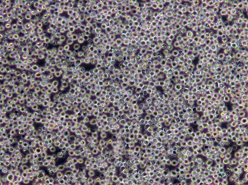 幽门螺杆菌琼脂粉末培养基,Helicobacter pylori Agar Medium Base
