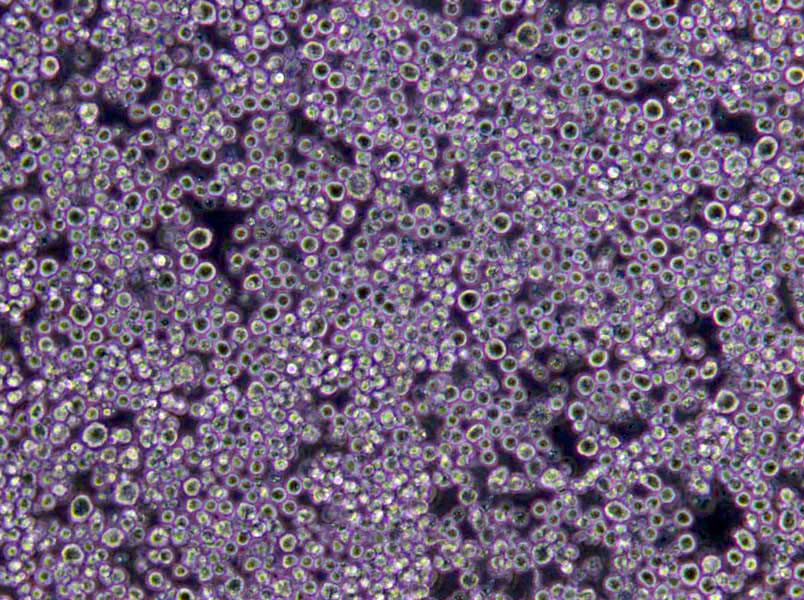 梭状芽孢杆菌计数琼脂粉末培养基,Clostridia Count Agar