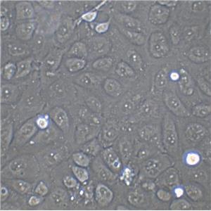 KP-N-RT-BM-1人神经母细胞瘤复苏细胞(附STR鉴定报告),KP-N-RT-BM-1