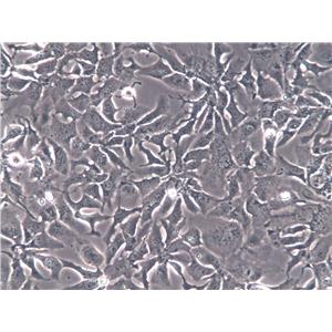 NCI-H2452人间皮瘤复苏细胞(附STR鉴定报告)