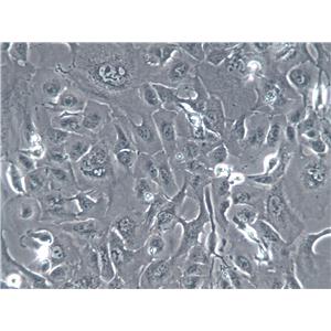 NCI-H2009人肺腺癌复苏细胞(附STR鉴定报告),NCI-H2009