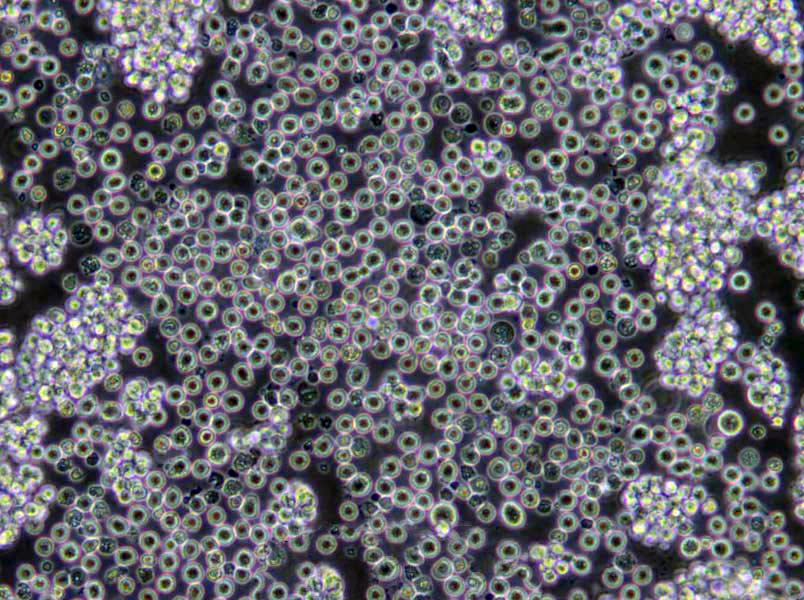 曙红亚甲蓝琼脂粉末培养基,Eosin-Methylene Blue Lactose Agar