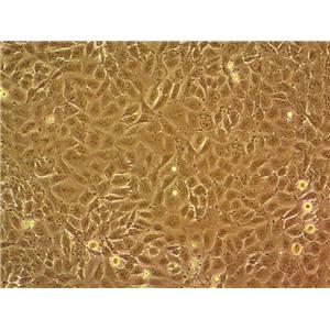 NCI-H1092人小细胞肺癌复苏细胞(附STR鉴定报告)