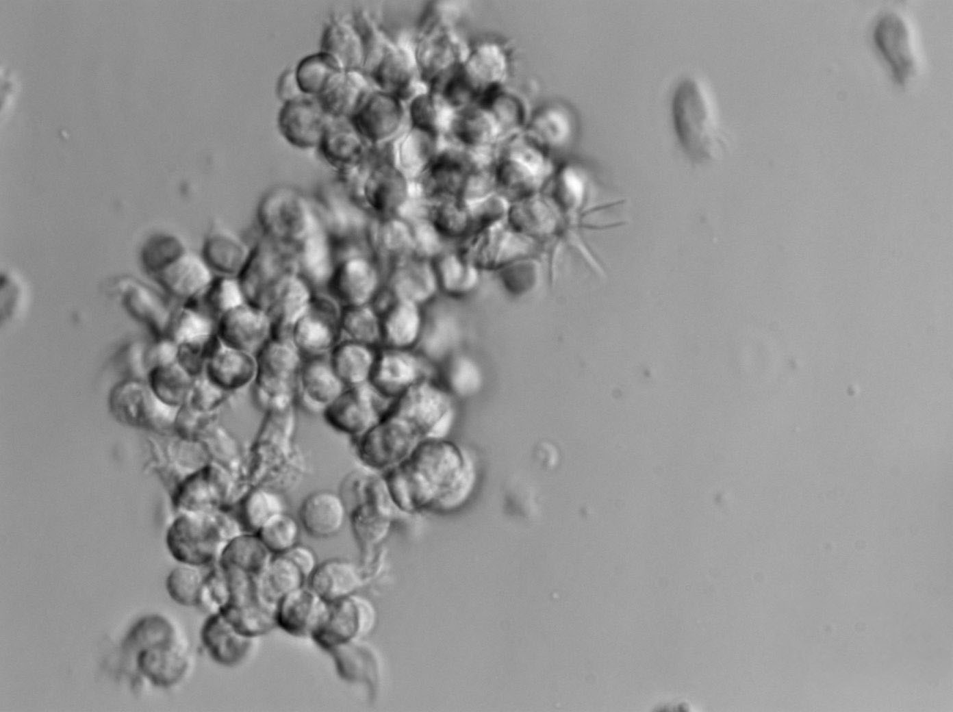 m-HPC瓊脂干粉培養(yǎng)基,Heterotrophic Plate Count Agar