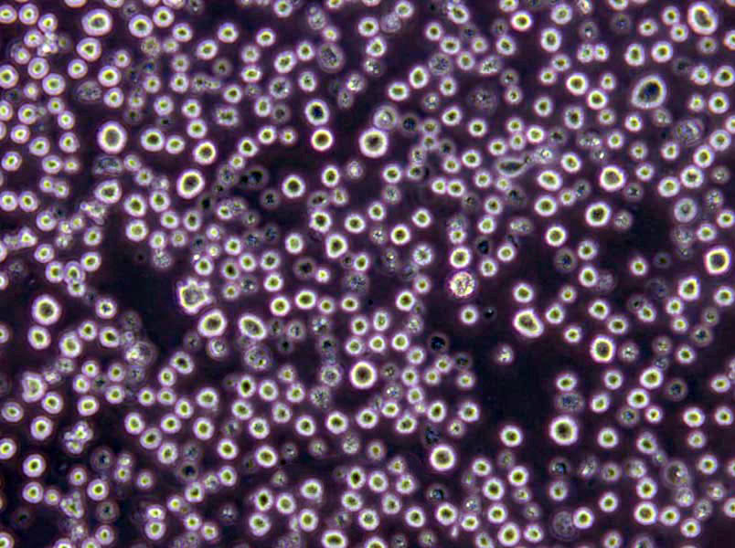 KM2豬肺炎支原體肉湯干粉培養(yǎng)基,KM2 Mycoplasma Hyopneumoniae Broth Medium