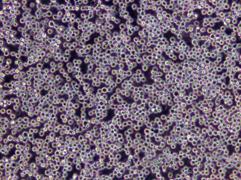 酵母氨基酸缺陷型合成琼脂干粉培养基[亮氨酸缺陷],Yeast Synthetic Drop-out Agar Medium without Leuci