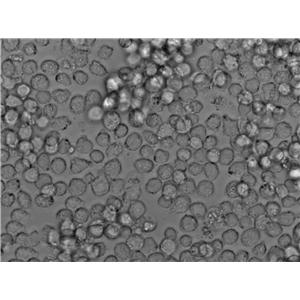 兔血浆纤维蛋白原[RPF]琼脂干粉培养基,RPF Agar Medium Base