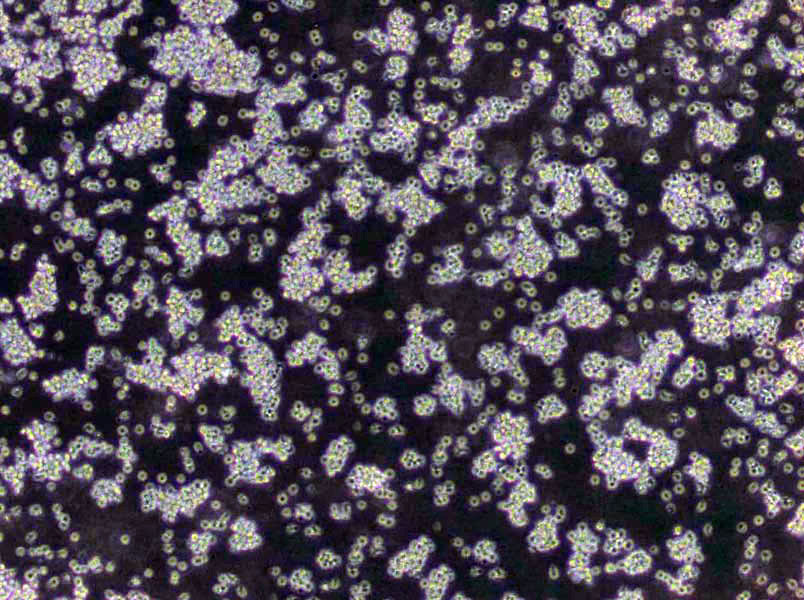 头孢磺啶-氯苯酚-新生霉素[CIN]琼脂干粉培养基,Cefsulodin-Chlorophenol-Novobiocin Agar