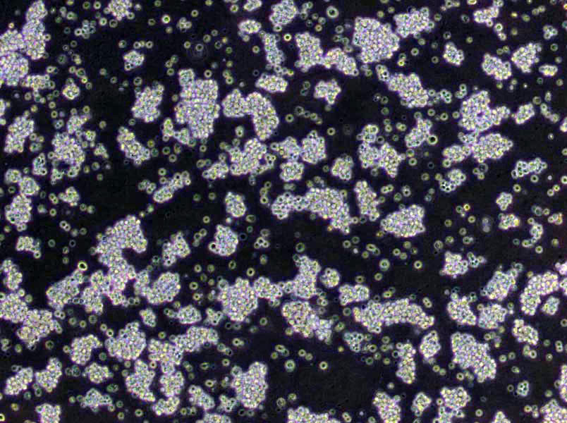 NCI-H146人小细胞肺癌复苏细胞(附STR鉴定报告),NCI-H146