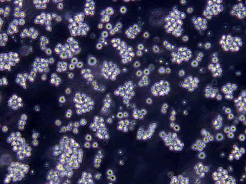 NCI-H69人小细胞肺癌复苏细胞(附STR鉴定报告),NCI-H69