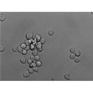 解脲支原体琼脂干粉培养基,Ureaplasma urealyticum Agar Base