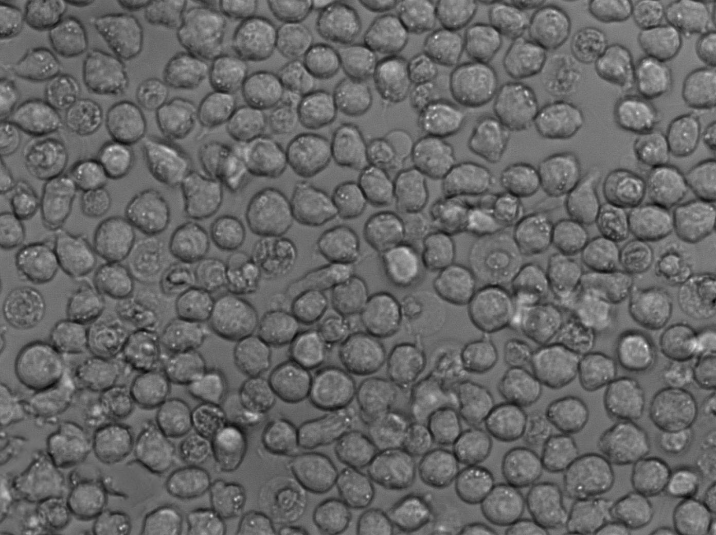 麥康凱肌醇阿東醇羧芐青霉素瓊脂干粉培養(yǎng)基,MIAC Agar Base