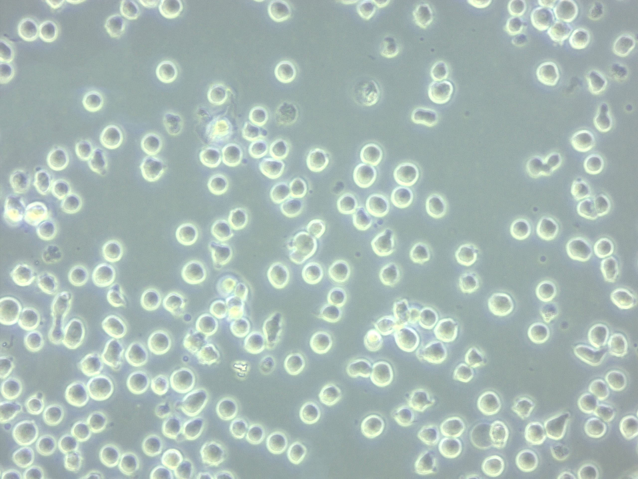 甘露醇卵黄多粘菌素琼脂干燥粉末培养基,Mannitol-Egg-Yolk-Polymyxin agar Base