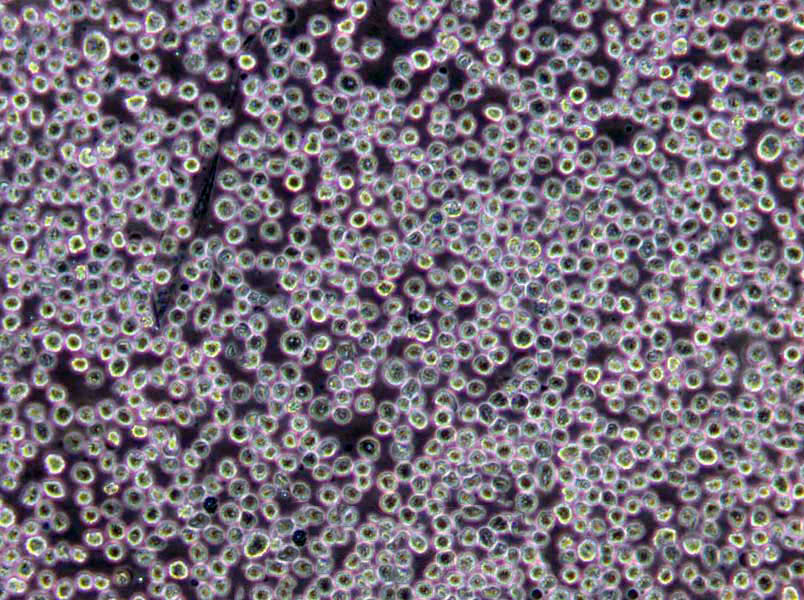 GC琼脂固体粉末培养基,GC Agar Base