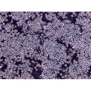 兔血浆纤维蛋白原[RPF]琼脂粉末状态培养基